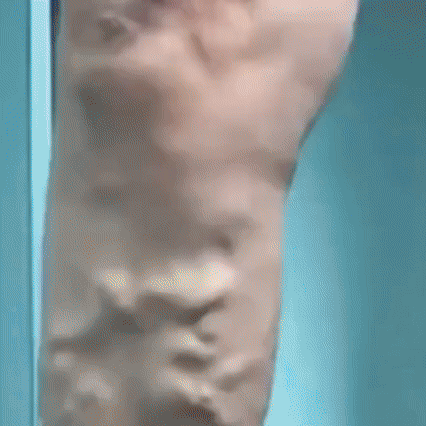 VARICOSE VEINS OINTMENT | Crema tratamiento de varices| Mejora la apariencia de arañitas | Uso diario unisex