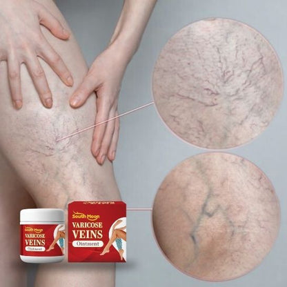 VARICOSE VEINS OINTMENT | Crema tratamiento de varices| Mejora la apariencia de arañitas | Uso diario unisex