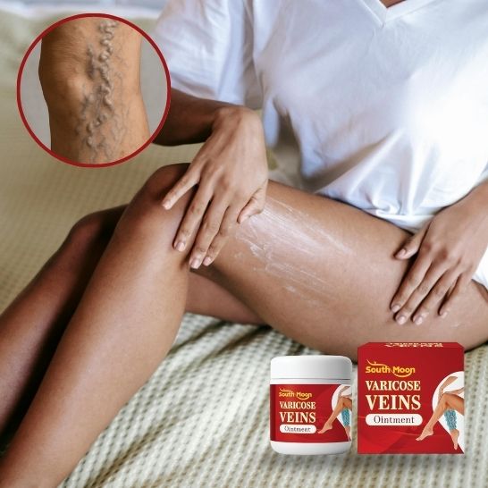 VARICOSE VEINS OINTMENT | Crema tratamiento de varices| Mejora la apariencia de arañitas | Uso diario unisex