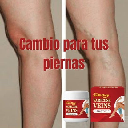 VARICOSE VEINS OINTMENT | Crema tratamiento de varices| Mejora la apariencia de arañitas | Uso diario unisex